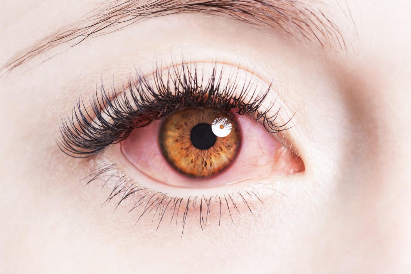 If your eyes are irritated due to fall eye allergies, contact us to learn more about treatment options.
