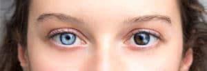 heterochromatic eyes