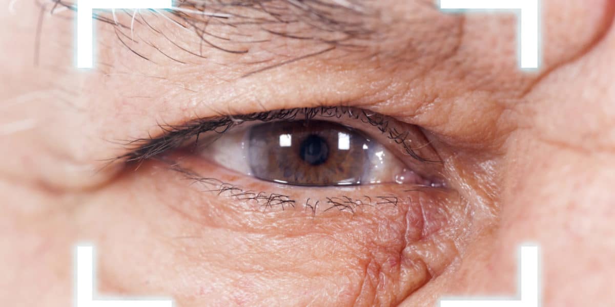 Refractive Cataract Surgery FAQ: The natural lens is replaced with an advanced multifocal lens rather than a standard synthetic lens in order to correct your vision. Refractive cataract surgery can correct shortsightedness, farsightedness, and astigmatism.